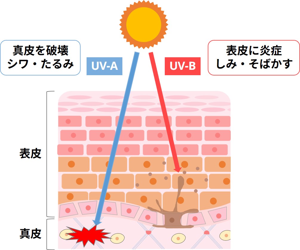 紫外線の肌への影響